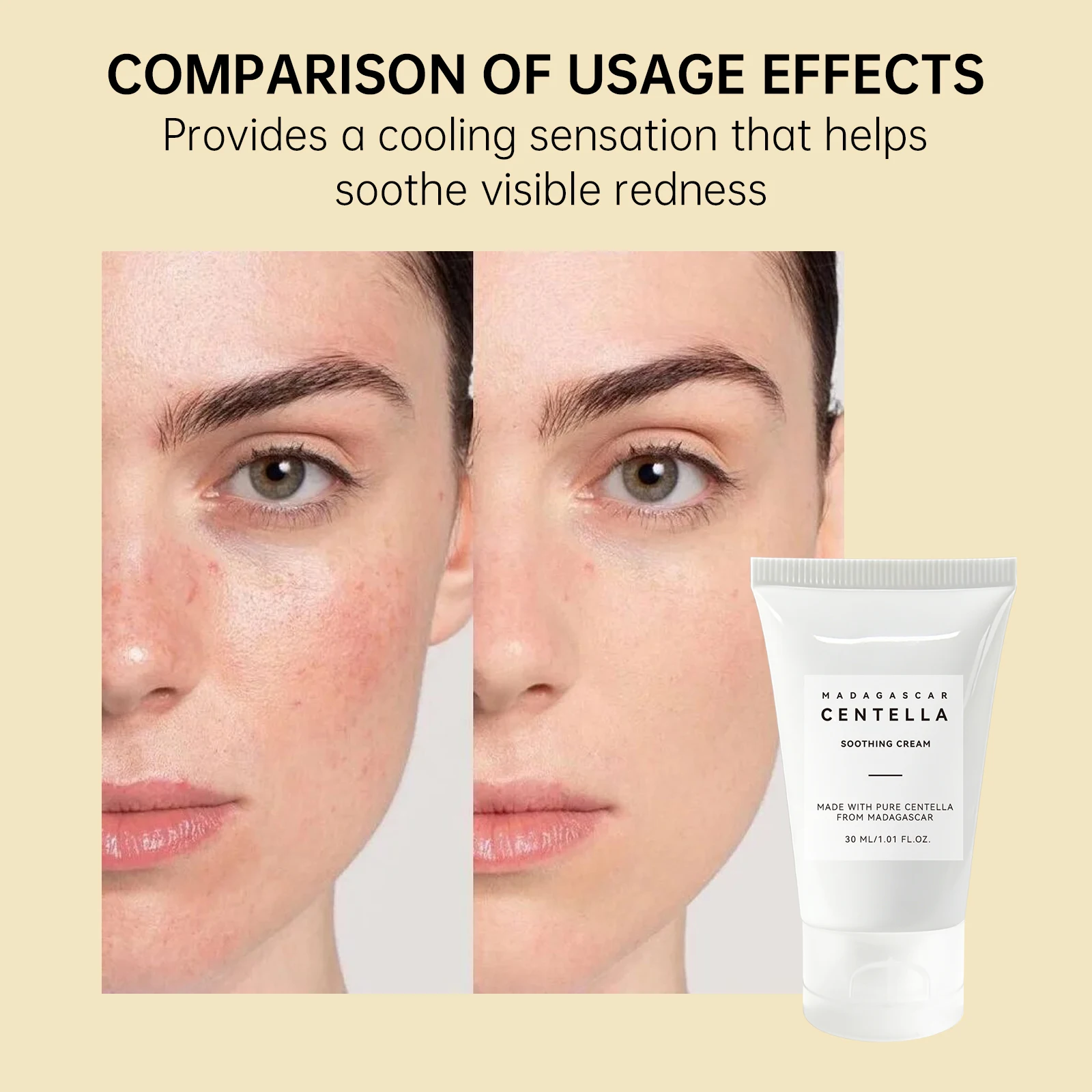 เซนเทลล่า เอเชียติก้า ซูทติ้ง  - Skincare Centella บทวิจารณ์และราคา