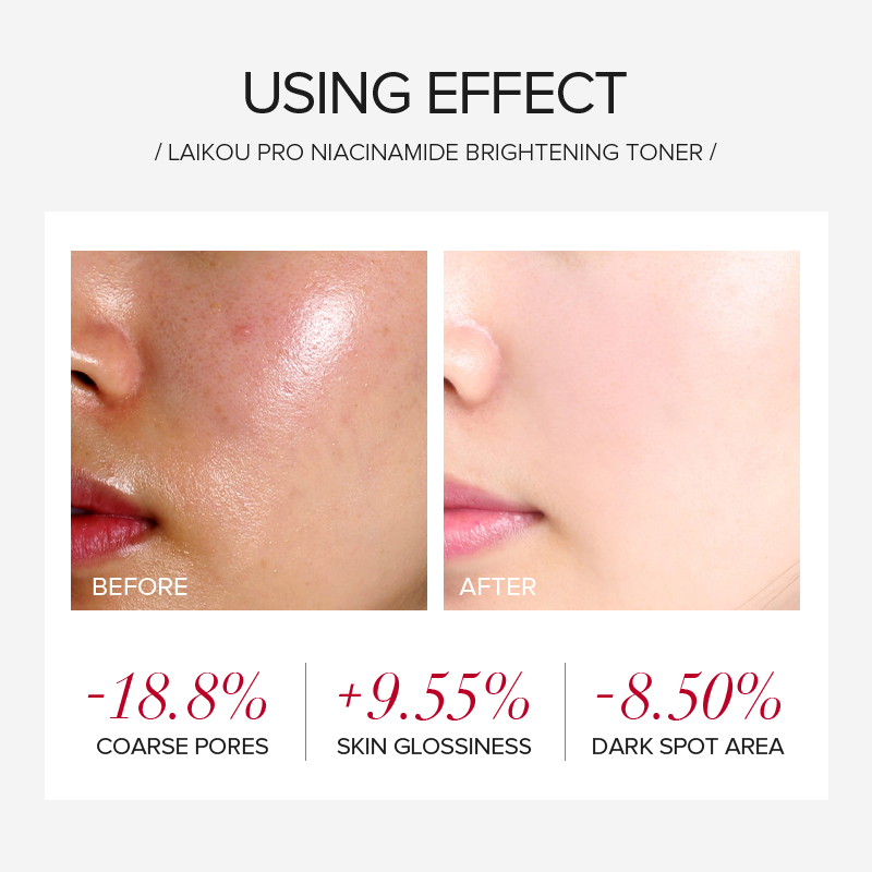 LAIKOU PRO ไนอาซินาไมด์ ชุดผลิ - Niacinamide Brightening Serum บทวิจารณ์และราคา