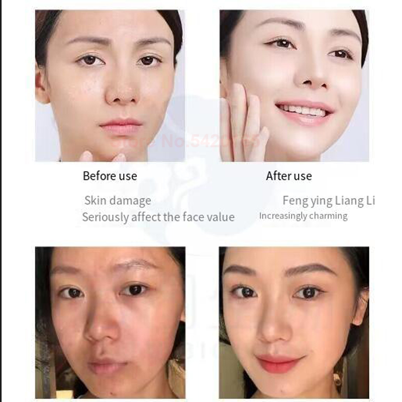 ไมโครนีดเดิล 0.25 มม. GHK-Cu บ - Licorice Root Extract บทวิจารณ์และราคา