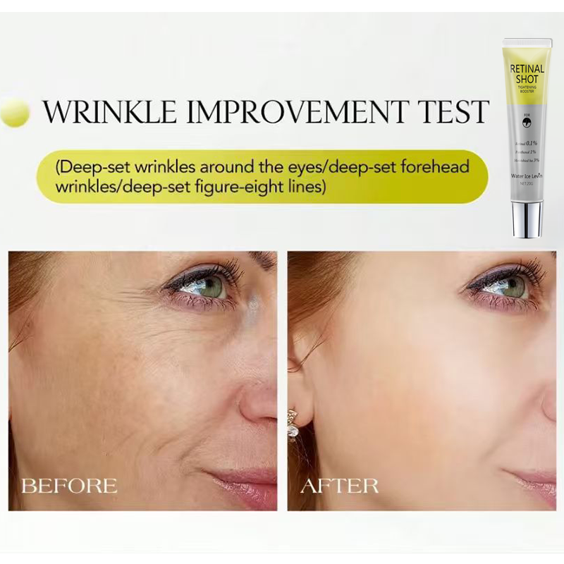 เรตินอล 0.1% อินเทนซีฟ ช็อต แพ - Retinol Vitamin A Cream บทวิจารณ์และราคา
