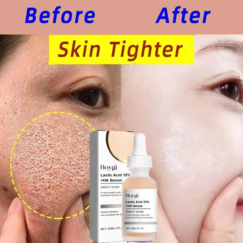 Lactic Acid Shrink Pores Serum - Licorice Root Extract บทวิจารณ์และราคา