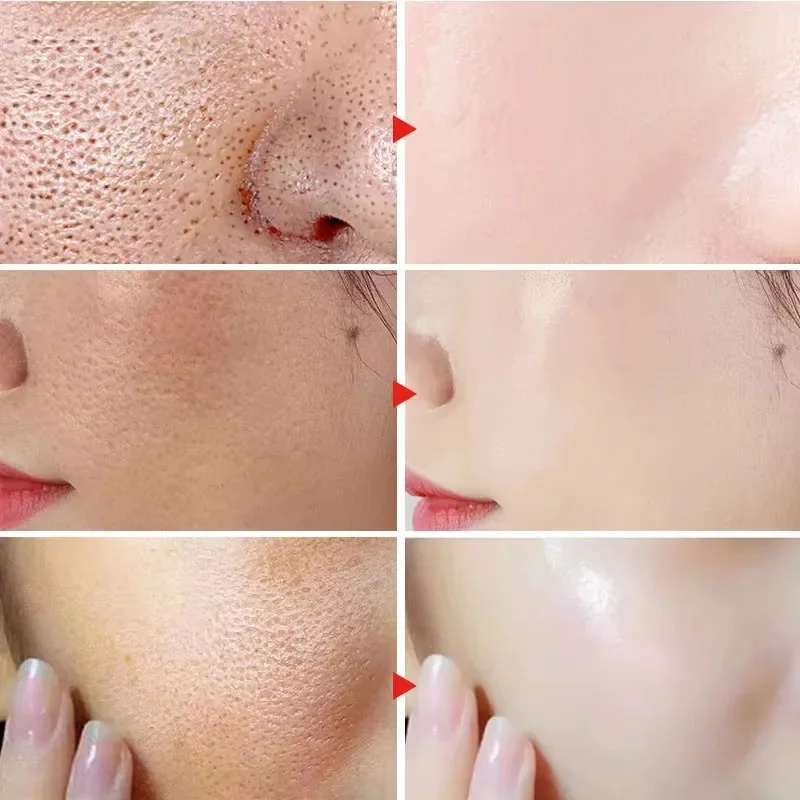 Lactic Acid Shrink Pores Serum - Licorice Root Extract บทวิจารณ์และราคา
