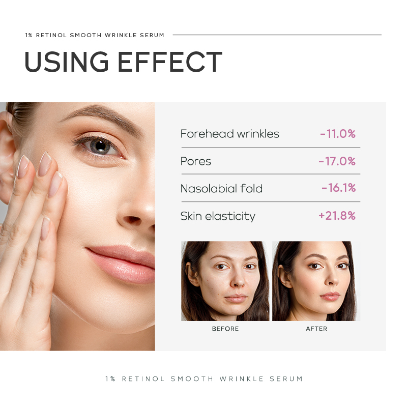 เซรั่มลดเลือนริ้วรอย Quiyum 1% - Niacinamide Brightening Serum บทวิจารณ์และราคา