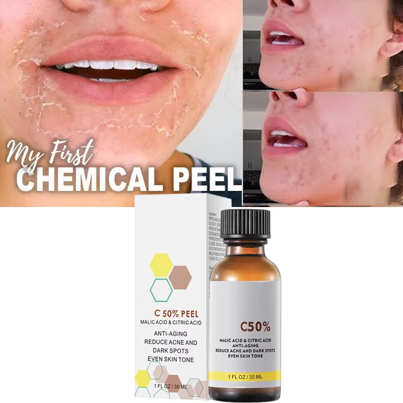 ด้วย Malic Acid และกรดซิตริกสํ - Licorice Root Extract บทวิจารณ์และราคา