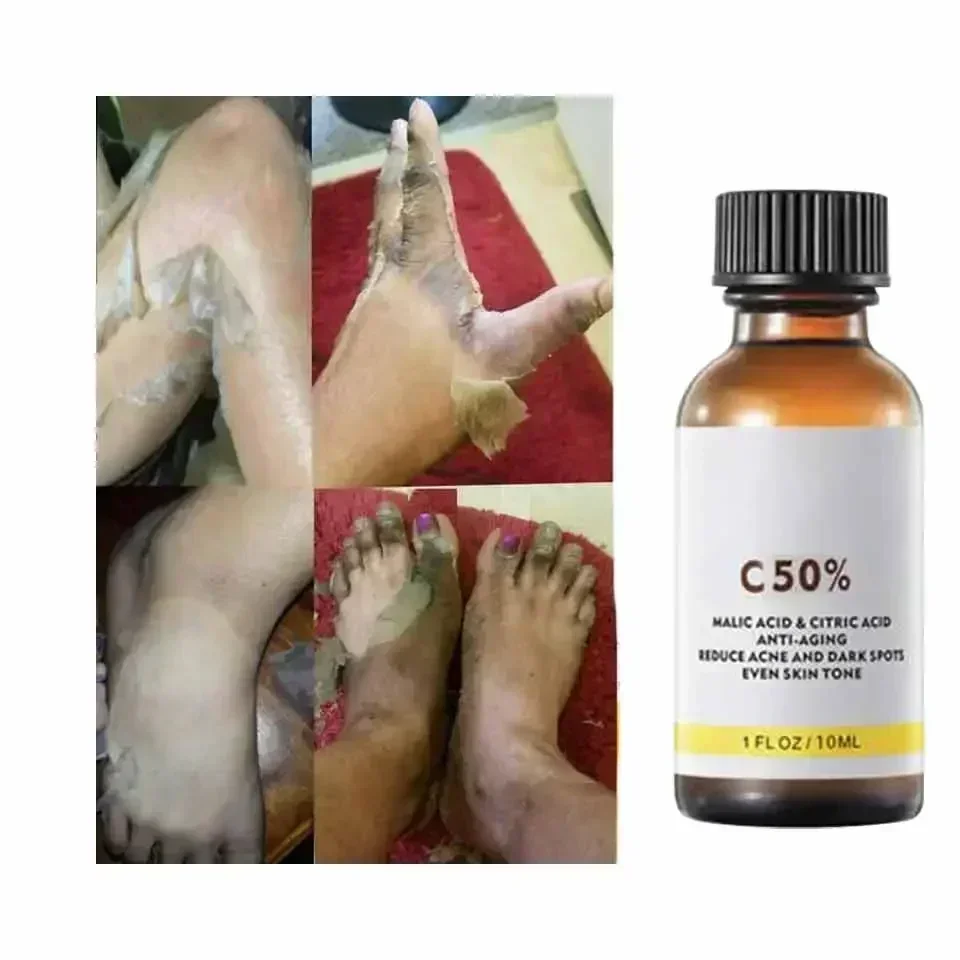 ด้วย Malic Acid และกรดซิตริกสํ - Licorice Root Extract บทวิจารณ์และราคา